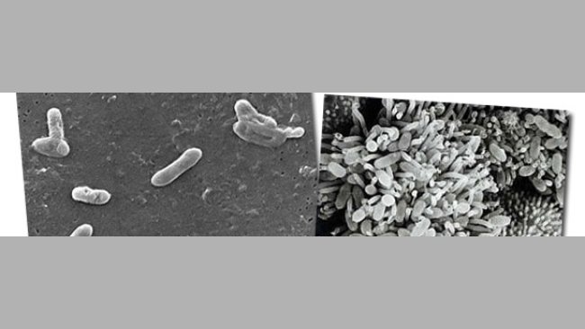 Los agentes causantes de la rinitis atrófica: una banda muy organizada