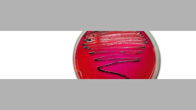 Aislamiento de Salmonella en XLD. En este medio las colonias de salmonella crecen de color negro debido a la producción de ácido sulfhidrico.