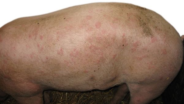 Forma cut&aacute;nea o urticante de la erisipela porcina.