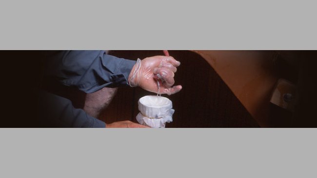 Extracción de semen