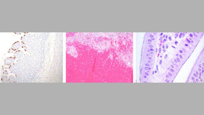 Rotavirus, E.coli y Clostridium perfringens
