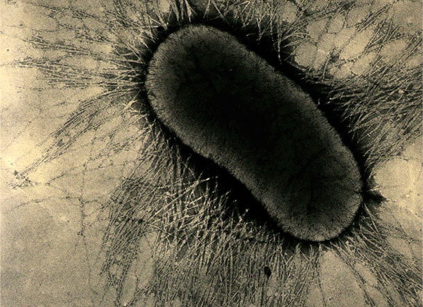 Los factores de adhesi&oacute;n de ETEC son prote&iacute;nas especializadas de las fimbrias o pilus, que se adhieren fuertemente a los receptores de glicoprote&iacute;na de las c&eacute;lulas intestinales