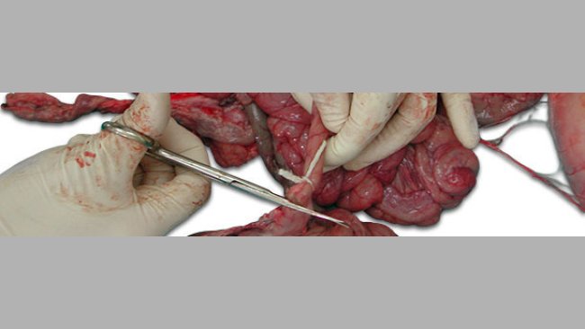 Ligar el tramo del intestino por los extremos antes de cortar.