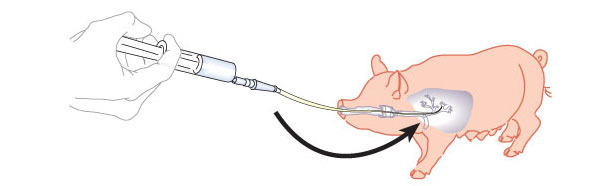 Figura 1. Esquema de lavado broncoalveolar y raspado bronquial.
