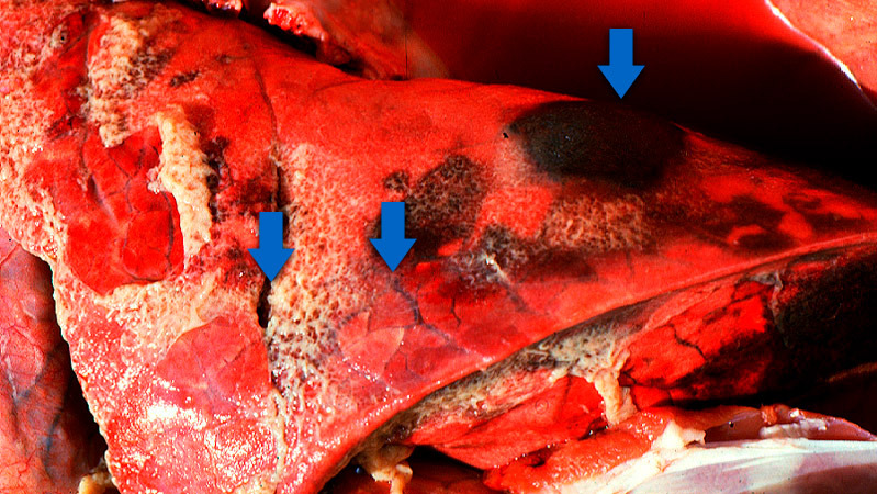 Los tres hallazgos t&iacute;picos de la pleuropneumonia porcina aguda: 1) &aacute;reas consolidadas de color rojo oscuro a negro; 2) edema interlobular y 3) pleuritis fibrinosa. Cortes&iacute;a del Dr Robert Desrosiers
