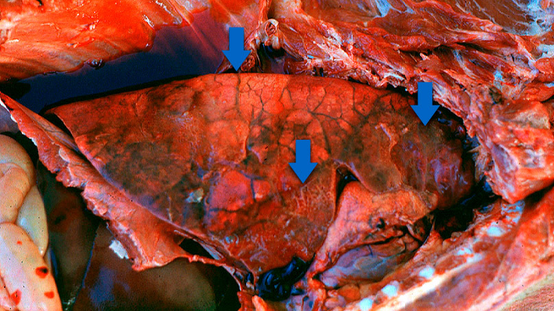 Pleuroneumon&iacute;a aguda en porcino: Normalmente se pueden observar 3 caracter&iacute;sticas (flechas): &aacute;reas consolidadas de color rojo-oscuro a negro, edema interlobular y pleuritis fibrinosa. Foto cortes&iacute;a del Dr Robert Desrosiers.
