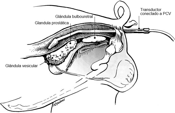 Figura 1: Colocación del soporte del transductor con el transductor por recto para la visualización de glándulas sexuales accesorias del verraco (Clark & Althouse, 2002). 