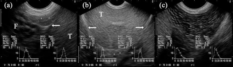 Figura 5: Imágenes ultrasonográficas de los segmentos del epidídimo: caput (= cabeza, a), corpus (b) y cauda (= cola; c). Las cajas marcadas con "+" y "x" se proyectan en los segmentos respectivos del epidídimo. Testículo (T). Junto a la cabeza hay estructuras tubulares múltiples identificadas como partes del funiculus spermaticus (F). Las flechas indican la cubierta testicular serosa (es decir, bursa testicularis). (Kauffold et al., 2011)