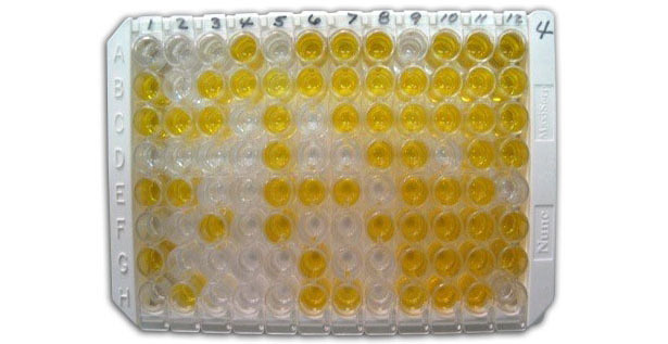 Figura 1: ELISA indirecto para la detecci&oacute;n de anticuerpos anti-clamidia en suero.
