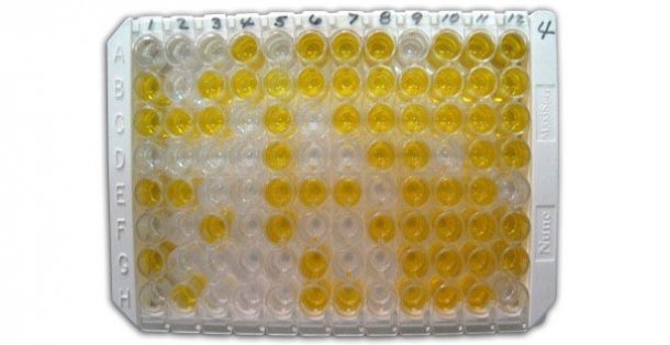 Figura 1: ELISA indirecto para la detecci&oacute;n de anticuerpos anti-clamidia en suero.
<br>