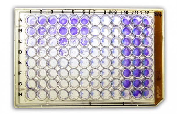 Figura 2a: seroneutralizaci&oacute;n&nbsp;(SN) para la detecci&oacute;n de anticuerpos frente a herpesvirus bovino tipo 1 (BHV-1) en suero.
<br>