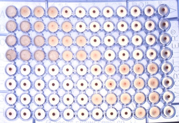 Figura 3: Test de la hemoaglutinaci&oacute;n para la detecci&oacute;n de anticuerpos anti-Brucela en suero.
<br>