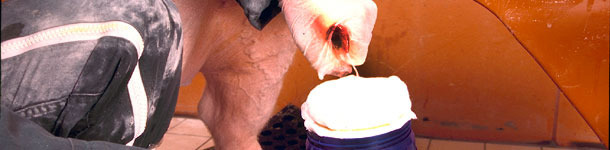 Las enfermedades y el semen