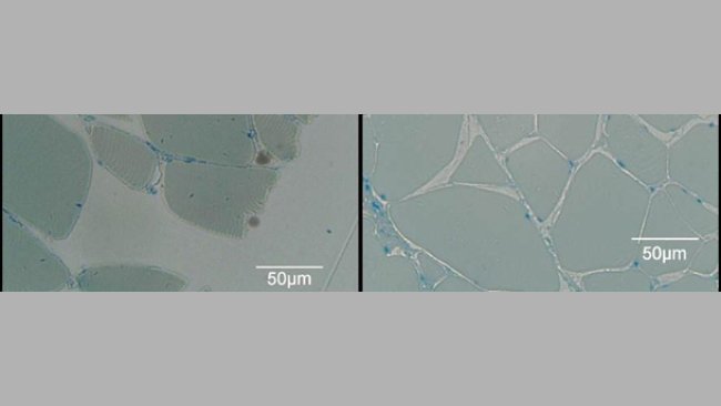 En la figura de la izquierda, jamón curado no presurizado. A la derecha, el mismo jamón presurizado a 600 MPa. Imágenes obtenidas por microscopia óptica.