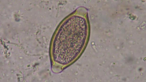 Figura 1. Larva de Trichuris suis
