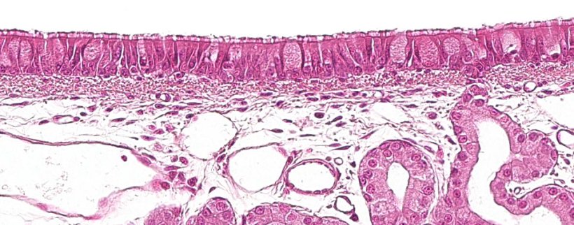 Figura 1: Epitelio seudoestratificado ciliado con células caliciformes característico del aparato respiratorio.