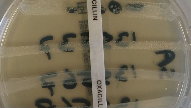 resistencia antimicrobiana