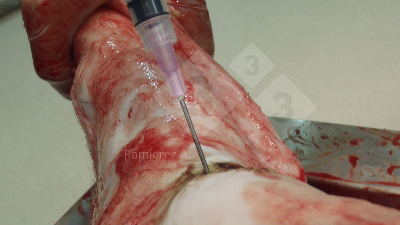 Figura 1. Recogida de muestra&nbsp;de l&iacute;quido articular en un cerdo muerto. Se elimina&nbsp;la piel y se usa una jeringa para recoger&nbsp;el l&iacute;quido articular de forma as&eacute;ptica.

