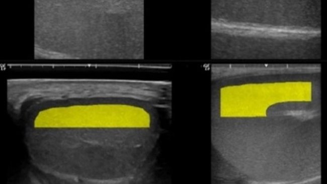 Imagen 2: Selección automática de áreas de interés