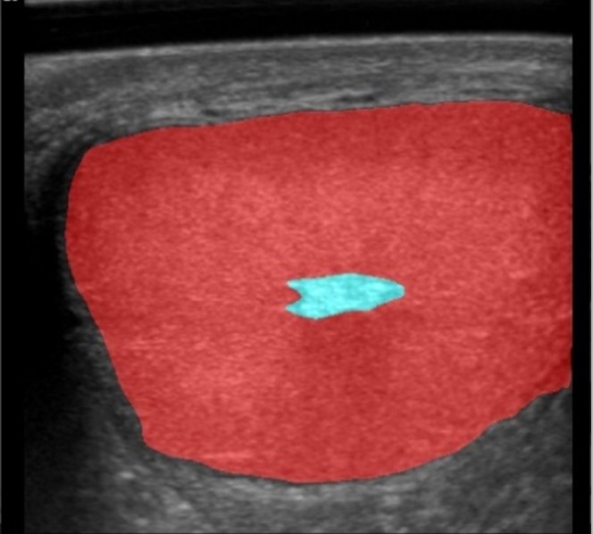 Imagen 1:&nbsp;Identificaci&oacute;n del tejido germinativo
