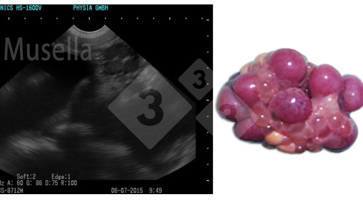 Figura 1. Cuerpo l&uacute;teo.
