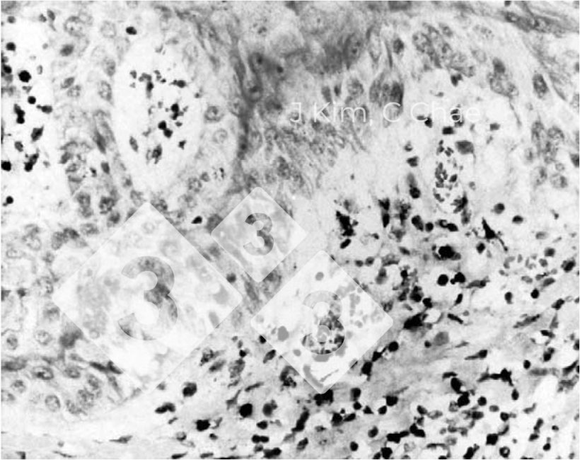 Figura 2.&nbsp;Presencia concurrente de circovirus porcino tipo 2 y parvovirus porcino en casos retrospectivos. Fuente: J. Kim, C.Chae- The Veterinary Journal 167 (2004) 104&ndash;106. Short communication
