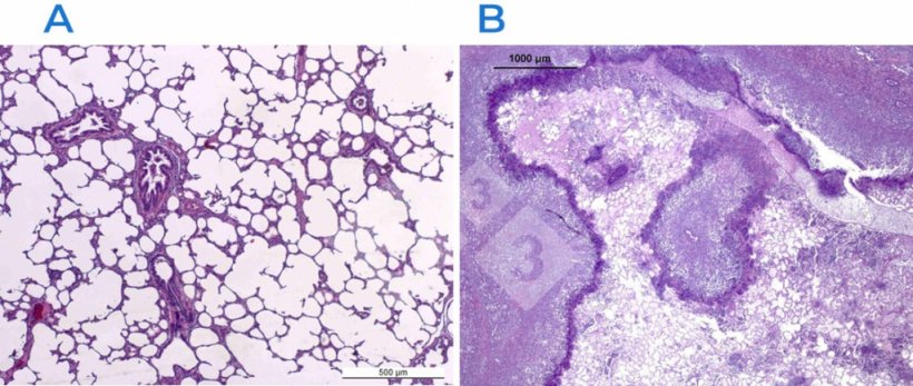 Figura 2. Tinci&oacute;n hematoxilina-eosina&nbsp;en un pulm&oacute;n normal (A) y afectado (B). El pulm&oacute;n en B est&aacute; afectado por una pleuroneumon&iacute;a fibrino-necrotizante causada por Actinobacillus pleuropneumoniae.
