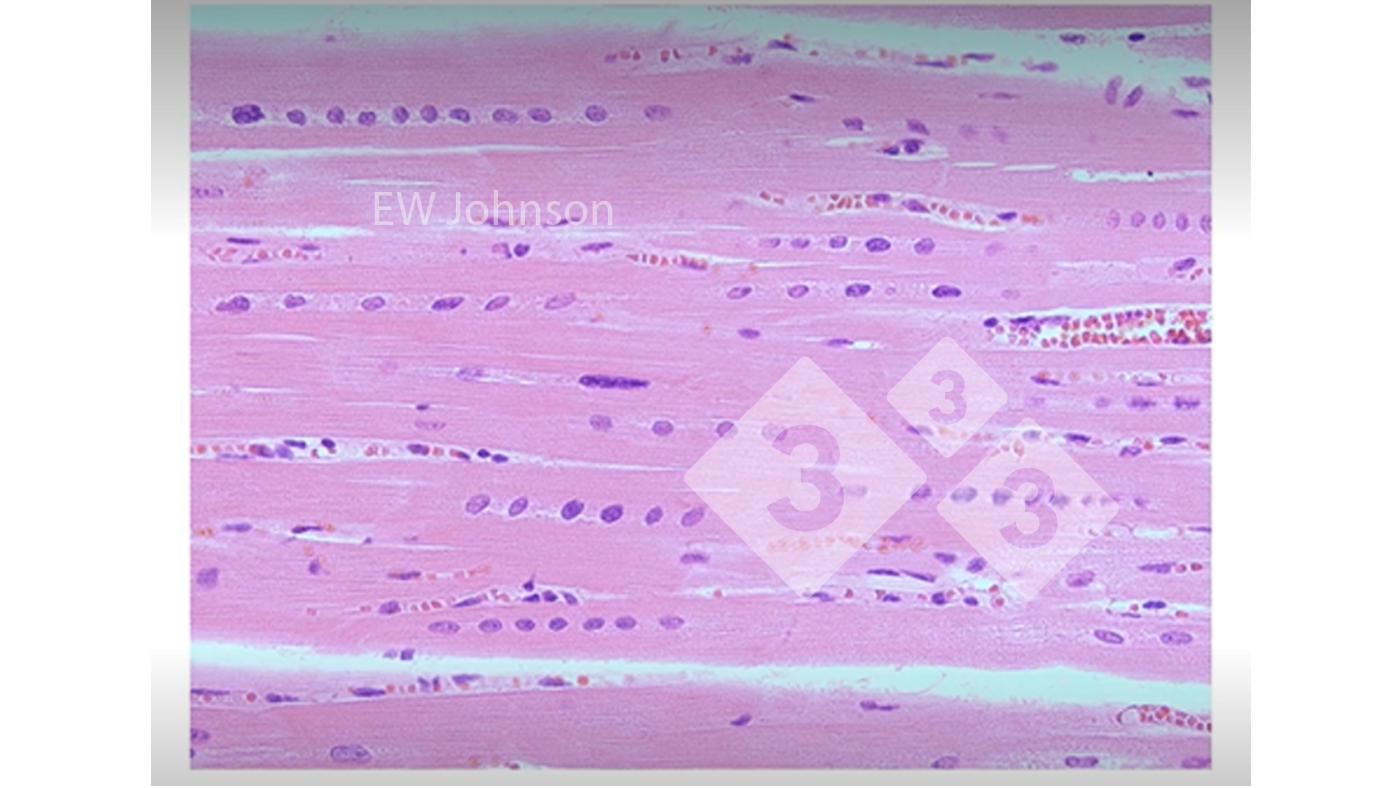 Figure 3: Heart muscle with haemorrhage, hyaline necrosis, and rowing of the nucleus showing vitamin E and selenium deficiency. These pigs would not have a normally functioning immune system.
