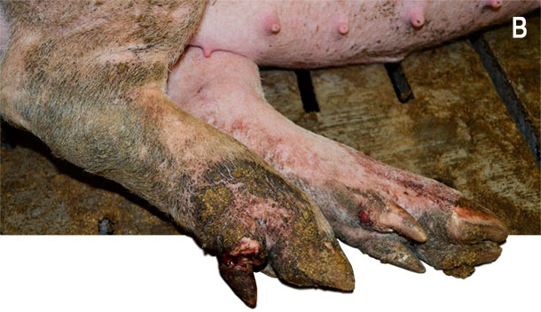 Ergots amput&eacute;s