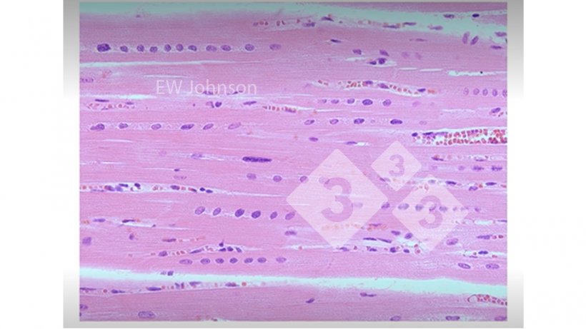 Figure 3. Muscle cardiaque avec h&eacute;morragie, n&eacute;crose hyaline et alignement des noyaux montrant une carence en vitamine E et en s&eacute;l&eacute;nium. Ces porcs n&#39;auraient pas un syst&egrave;me immunitaire fonctionnant normalement.
