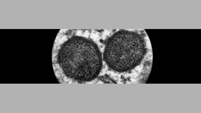 Cuerpos de inclusión en un macrófago