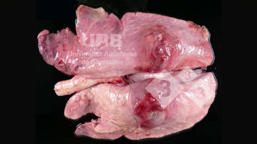 Figura 1. Pleuropneumonia fibrino-necrotizante compatible con App. Fuente:&nbsp;UAB.
