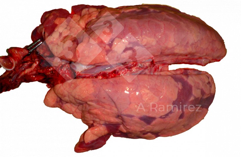 Figura 3: Infecci&oacute;n por influenza A de presentaci&oacute;n irregular y difusa con ligero edema interlobular.
