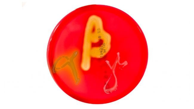 Figura 1. Cultivos en placas de Petri en agar sangre que muestran hemólisis alfa, beta y gamma. Fuente: Mibilehr https://creativecommons.org/licenses/by-sa/4.0/deed.ene 
