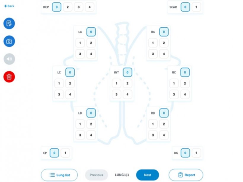 Figura 2. Software digital utilizado para la evaluaci&oacute;n.&nbsp;Las partes de los pulmones valoradas en una escala de puntos inclu&iacute;an el l&oacute;bulo apical izquierdo, el l&oacute;bulo card&iacute;aco izquierdo, el l&oacute;bulo diafragm&aacute;tico izquierdo, el l&oacute;bulo intermedio, el l&oacute;bulo diafragm&aacute;tico derecho, el l&oacute;bulo card&iacute;aco derecho, el l&oacute;bulo apical derecho, as&iacute; como las zonas afectadas por pleuritis craneal, pleuritis dorso-caudal y la presencia de cicatrices.
