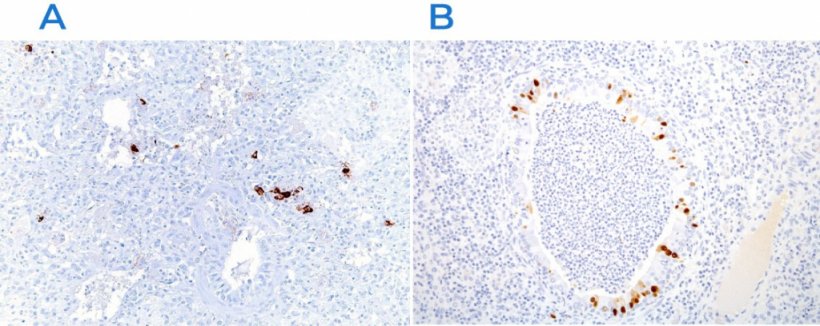 Figura 3. Inmunohistoqu&iacute;mica para detectar el virus del s&iacute;ndrome respiratorio y reproductivo porcino (PRRSV) (A) y el virus de la gripe porcina (B). La presencia del ant&iacute;geno v&iacute;rico (tinci&oacute;n marr&oacute;n) se encuentra en las zonas afectadas.
