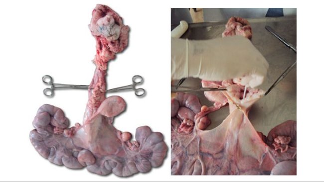 Aparelho reprodutivo da nulipara e Abertura da cervix para coleta da secreção com swab