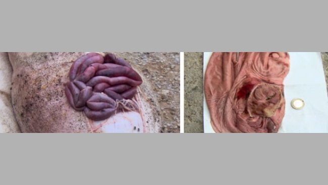 Úlceras gástricas agudas