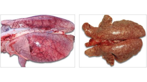 Pulmones