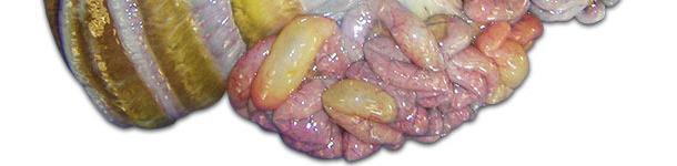 Factores de riesgo asociados a la enfermedad de los edemas