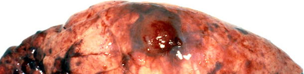 Lesi&oacute;n t&iacute;pica de Acpp &ndash; la lesi&oacute;n pulmonar hemorr&aacute;gica y necr&oacute;tica est&aacute; cubierta por una adherencia pleural.