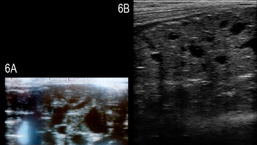 Figura 6: Im&aacute;genes de la gl&aacute;ndula bulbouretral del verraco afectado con m&uacute;ltiples quistes anecog&eacute;nicos bien definidos de diferentes &nbsp;tama&ntilde;os&nbsp;(A) y de un verraco sano&nbsp;(B) (Grahofer et al., 2016).
