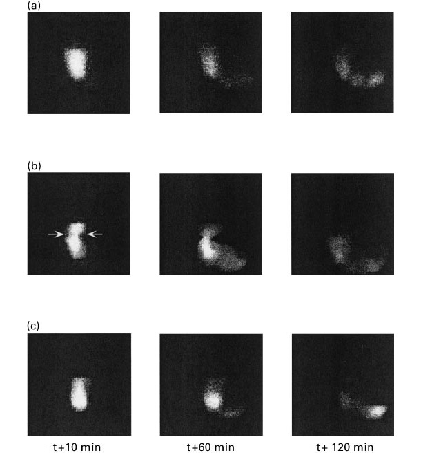 Figura 1. Im&aacute;genes del vaciado g&aacute;strico en cerdos alimentados con una dieta basada en almid&oacute;n (a), pulpa de remolacha (b) y salvado de trigo a los 10, 60 y 120 minutos post-ingesti&oacute;n (Fuente: Guerin et al., 2001).
