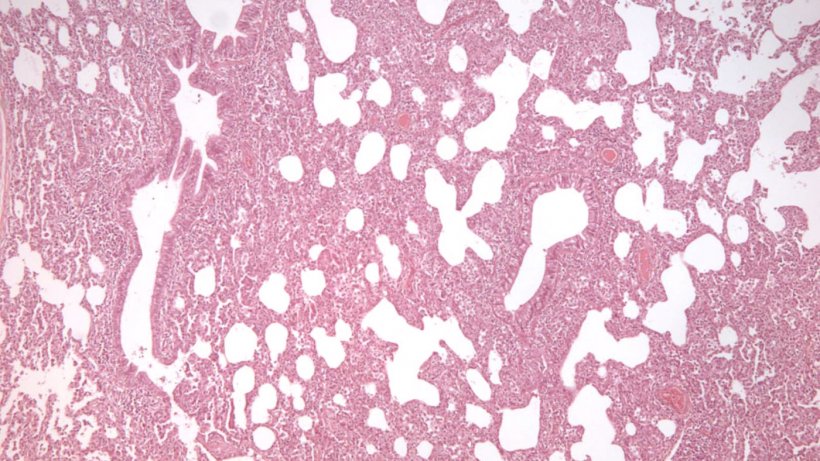 Figura 2: Neumon&iacute;a intersticial, caracterizada por el engrosamiento de los tabiques alveolares, en una infecci&oacute;n por el PRRSV.
