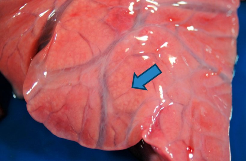 Figura 4: Bronconeumon&iacute;a purulenta: ampliaci&oacute;n de la consolidaci&oacute;n craneoventral donde se observan peque&ntilde;as &aacute;reas de color blanco-amarillento (flecha) que se corresponden con los alv&eacute;olos pulmonares llenos de material purulento. Tambi&eacute;n se aprecia edema intersticial.
