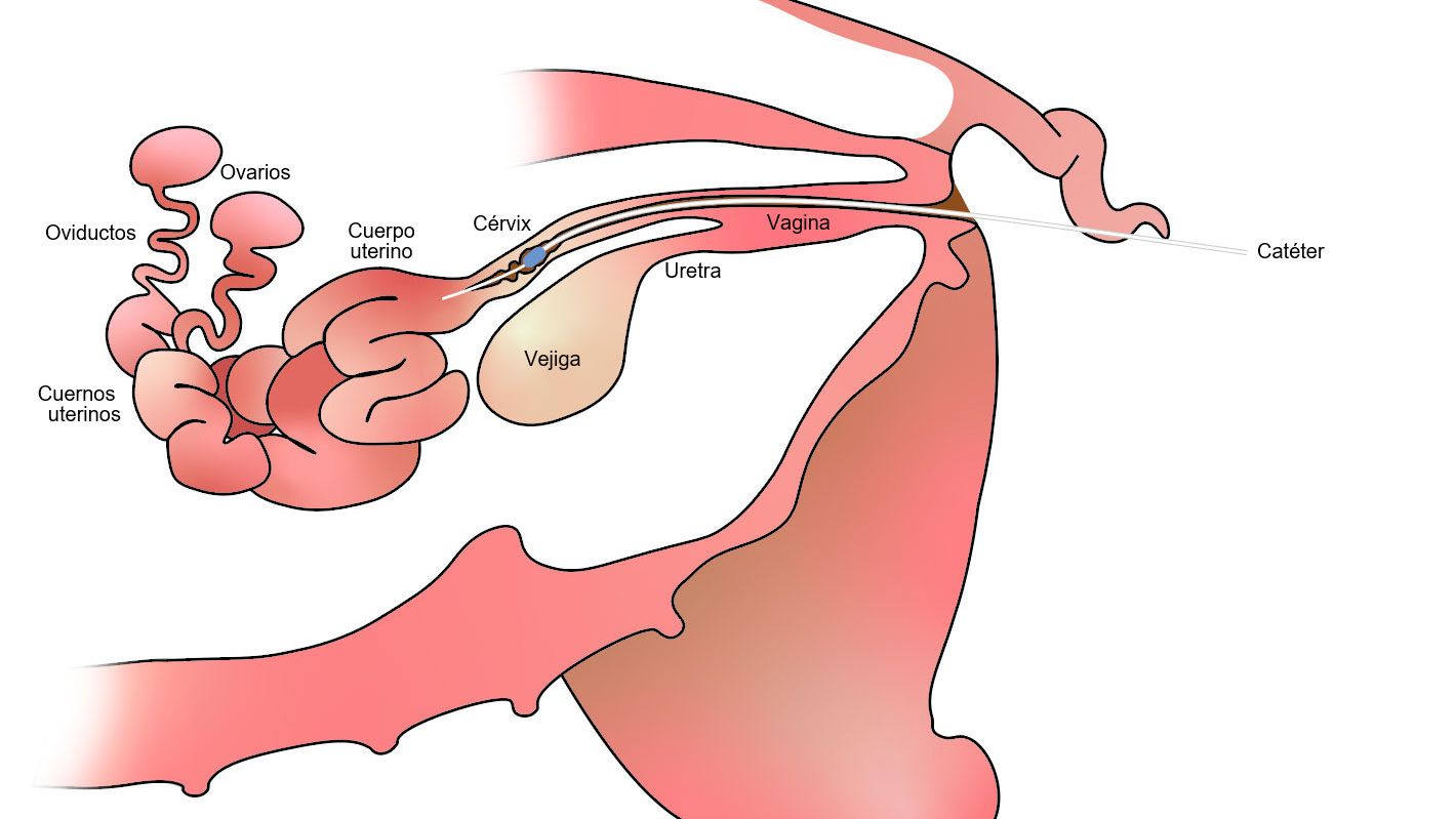 Consejos para la inseminación cervical - Artículos - 3tres3 Argentina, la  página del Cerdo