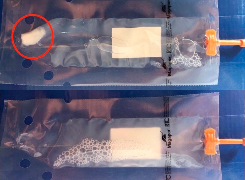照片2：上图可见精液沉淀，下图可见正确的均匀精液剂量。这种均质化将防止精子活力的丧失，并促进精子在培养基中的更好分布。