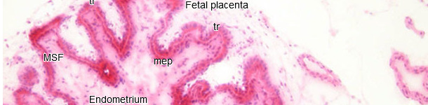 Histopathologische Untersuchung des Endometriums und der Plazenta
