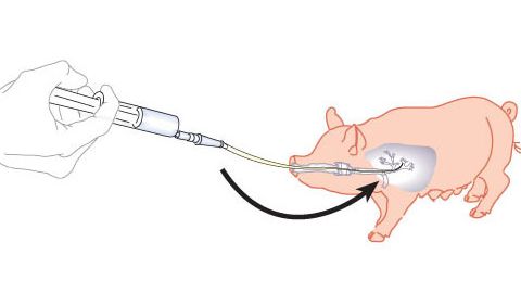 Abbildung 1: Schaubild, das eine bronchoalveol&auml;re Lavage und einen Bronchialabstrich zeigt
