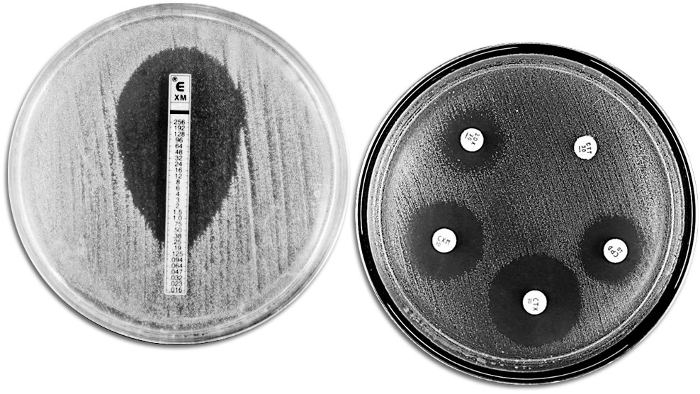 Klassische Verfahren zur Analyse der Antibiotikaresistenz: Das Bild zeigt auf der linken Seite einen E-TEST zur Messung der Mindestkonzentration von Antibiotika, bei der das Bakterienwachstum verhindert wird. Die rechte Seite zeigt einen Test zur Bestimmung der Antibiotikaempfindlichkeit mit verschiedenen Wachstumshemmungszonen, die durch die Antibiotika hervorgerufen wurden.
